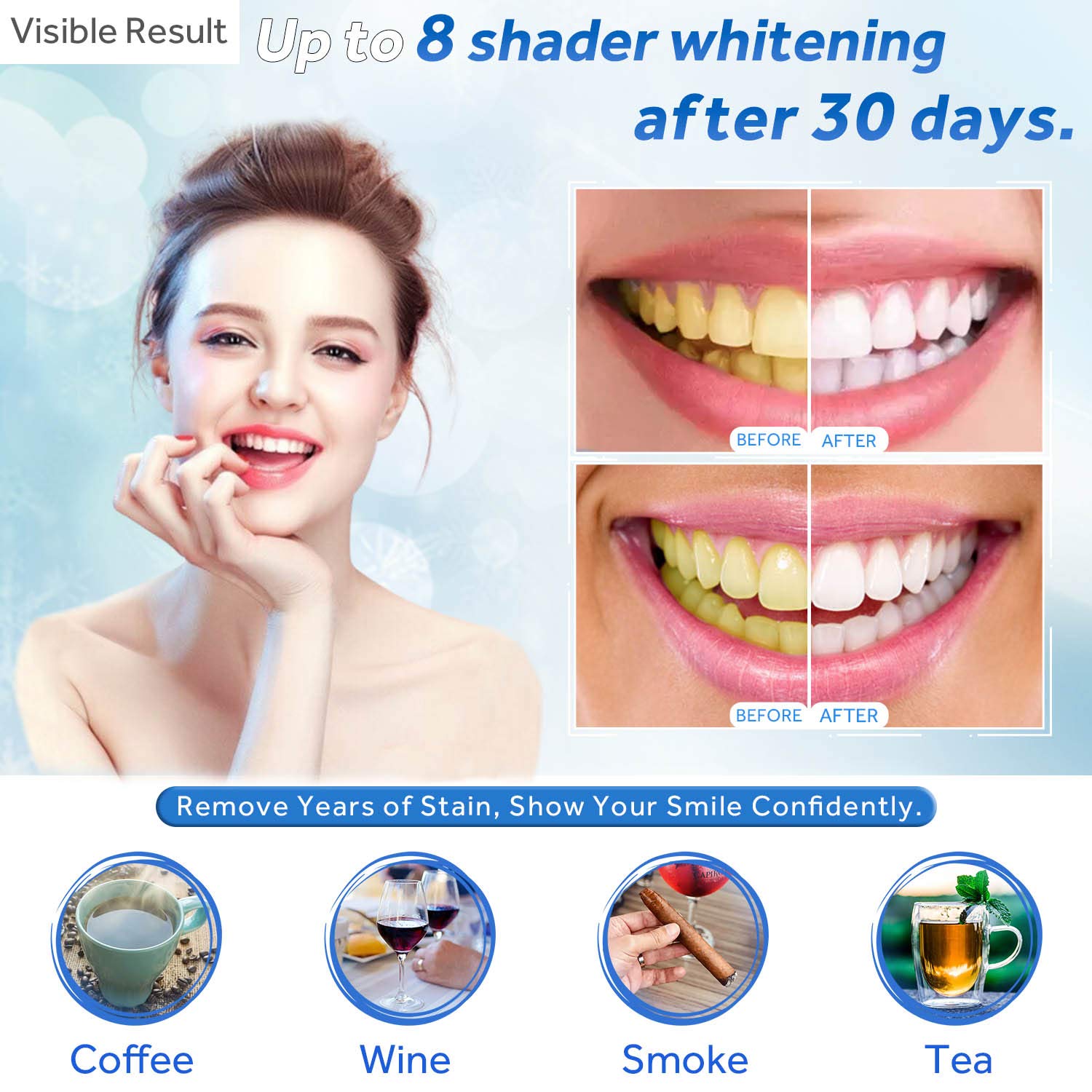 Gel de blanchiment des dents r - Teeth Whitening Procedure avis et prix