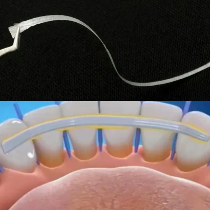 1-10 pièces Bande de fibre den - Teeth Whitening Strips Lumineux avis et prix